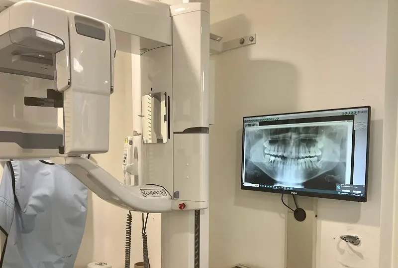 Shot of xray after patient finishes initial scan